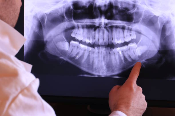Best Emergency Dentist for Special Needs Patients in Joshua, TX